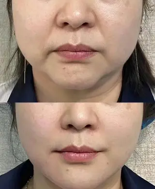 マツエク・マツパ 愛維美水光美肌専門店所属・愛維美水光美肌専門店 メンズレディースokのエステ・リラクイメージ