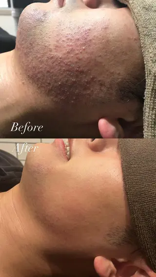 Lilyboo 多田のエステ・リラクイメージ