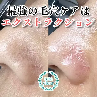 しおや ともこのエステ・リラクイメージ