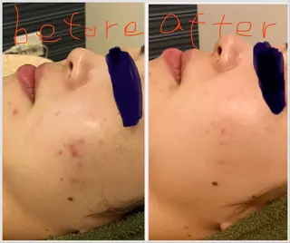 リラク&エステViola所属・阿部 まなのエステ・リラクイメージ