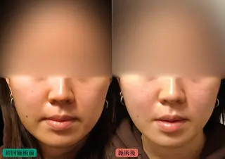 美容とカラダの鍼灸 サロン やなけんのエステ・リラクイメージ