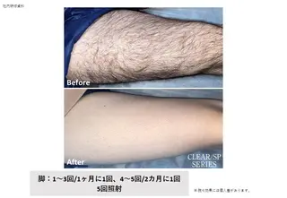 メンズ トータルクリア 田岡のエステ・リラクイメージ