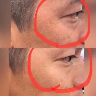 Meetite 小林のエステ・リラクイメージ