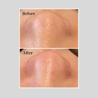 韓国肌管理 【毛穴専科】のエステ・リラクイメージ