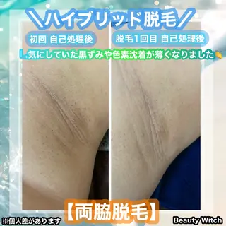 痩身/脱毛/ネイル HARUKAのエステ・リラクイメージ