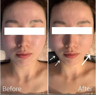 小顔🌼💕肌質改善 SalonBelleのエステ・リラクイメージ