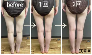 ECXIA 【エクシア】のエステ・リラクイメージ