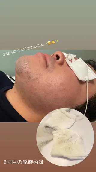 メンズ I'iris所属・【脱毛サロン iiris】占い可のエステ・リラクイメージ