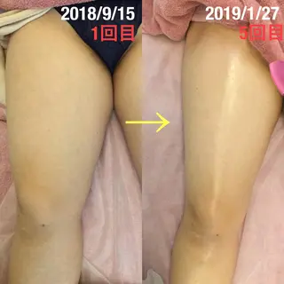 フェミニンエステ ティック大阪福島店のエステ・リラクイメージ