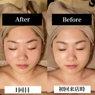 Ｂ&H所属・頭痛•肩こり専門/ 眉サロンB&H心斎橋のエステ・リラクイメージ