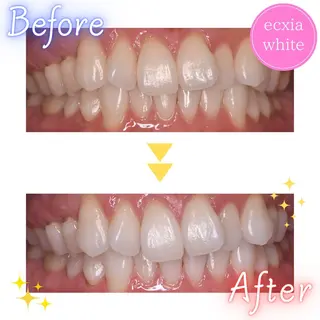 セルフホワイトニング エクシア泉中央店のその他イメージ