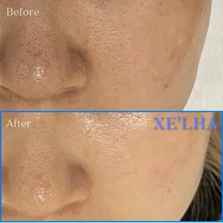 天神 MeMeのエステ・リラクイメージ