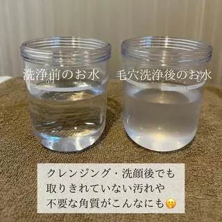 毛穴と美肌 littleroomのエステ・リラクイメージ