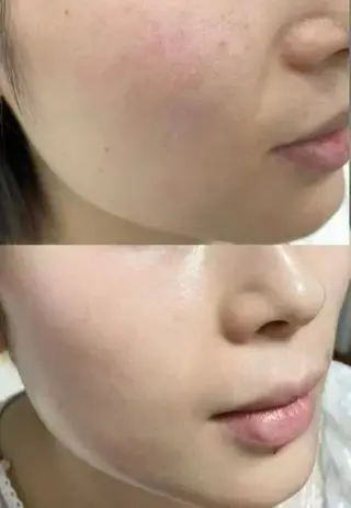 セミロング aliaハイフ&水光ジェットサロン所属・aliaハーブ水光店 エステティシャン募集のエステ・リラクイメージ