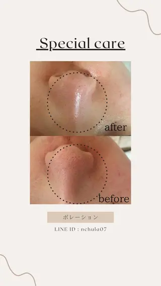 KOHAKU.所属・Nana Kikutaのエステ・リラクイメージ