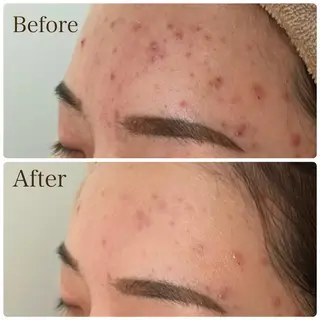 MiMiy 銀座店のエステ・リラクイメージ