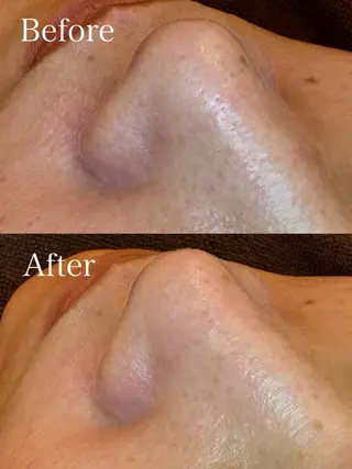 EARTH coiffure beaute 新潟紫竹山店所属・🤍アベシュリ /フェイシャル🤍のエステ・リラクイメージ