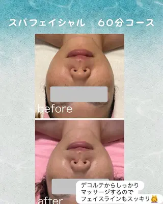 ekuRan by Rucia所属・ekuRan/ エステティシャン　愛のエステ・リラクイメージ