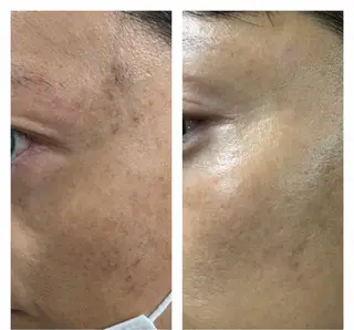 エルモサ痩身脱毛　西八王子店所属・エルモサ痩身脱毛 西八王子店のエステ・リラクイメージ