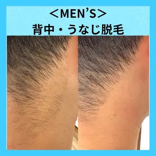 メンズ メディカルエステ マドンナのエステ・リラクイメージ