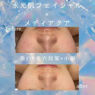 🌿小顔・痩身・脱毛 レイビス川崎店🌿のエステ・リラクイメージ