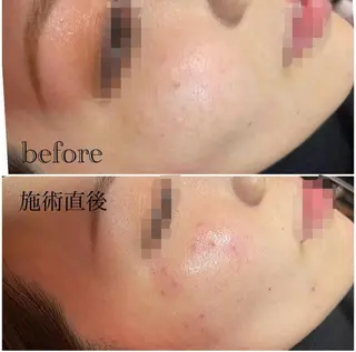 シミケア専門店 Saimervellのエステ・リラクイメージ