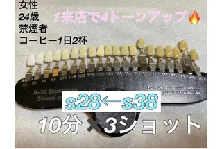 銀座deホワイトニング所属・銀座de ホワイトニングのその他イメージ