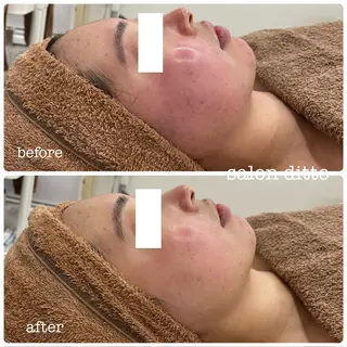 salon ditto所属・mio (小顔・ヘッドスパ)のエステ・リラクイメージ