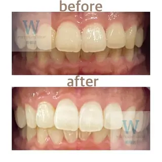 ホワイトニング ショップ船橋店🦷のエステ・リラクイメージ