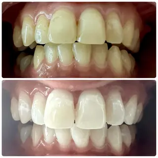 歯のホワイトニング専門店＆white所属・歯のホワイトニング 専門店&whiteのその他イメージ