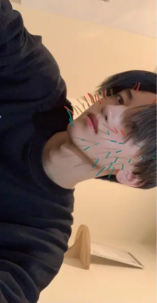 鍼灸整骨院Refine所属・鍼灸 Refineのその他イメージ