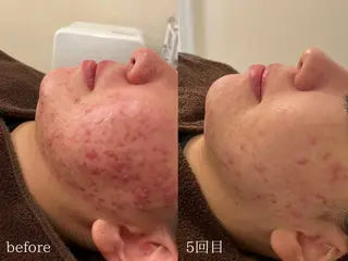 美肌ケアサロン iru【アイル】のエステ・リラクイメージ