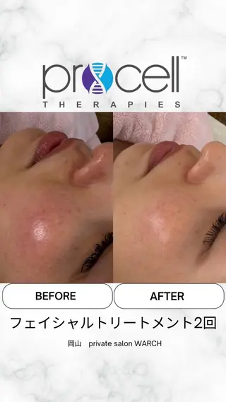 WARCH Marieのその他イメージ