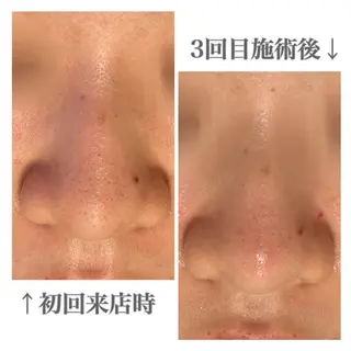 メンズ眉毛サロンラボ所属・メンズ眉毛サロンラボ 🫧 牧田 雪乃の眉毛・アイブロウイメージ