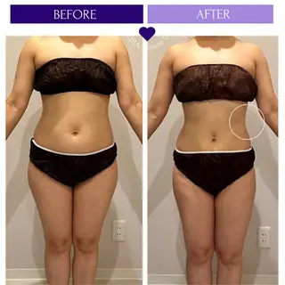 小顔＆まつ毛サロン AKANE❤️のエステ・リラクイメージ