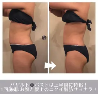 ラ・ルミエール所属・鈴木 えつこのエステ・リラクイメージ