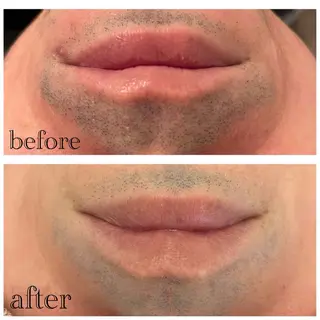 メンズ メンズ脱毛サロン　SHINKA所属・メンズ脱毛サロン SHINKAのエステ・リラクイメージ