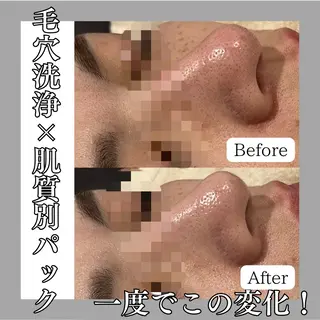 韓国肌管理専門店　White labo 梅田店所属・大西 亜季のエステ・リラクイメージ