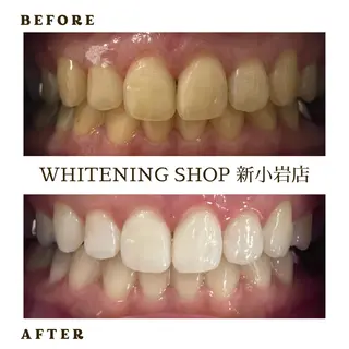 メンズ ホワイトニング ショップ新小岩店のその他イメージ