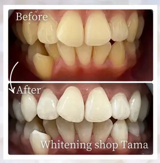 メンズ キッズ ホワイトニング ショップ多摩店のその他イメージ