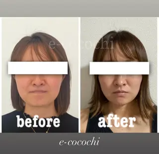 小顔と ヘッドスパのお店のエステ・リラクイメージ