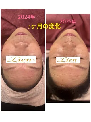 Lien オーナー　山口智嘉のエステ・リラクイメージ