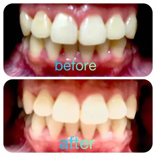 two nailのネイルデザイン