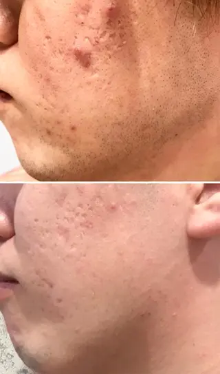 【EARTH鳥栖店】 小松美穂子のエステ・リラクイメージ