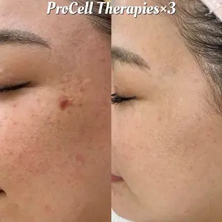 メンズ private salon Aola所属・プライベートサロン アオラのネイルデザイン