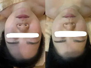 ビューティクリニックコダマ所属・池元 菜奈のエステ・リラクイメージ