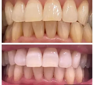 ホワイトニングサロン_ホワイト福島所属・ホワイトニング ホワイトのその他イメージ