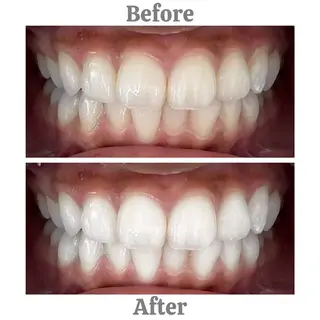 セルフホワイトニング　エクシア相模大野店所属・mo moのその他イメージ