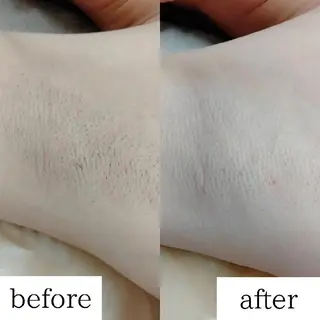 みんなの脱毛 TSURURINの眉毛・アイブロウイメージ