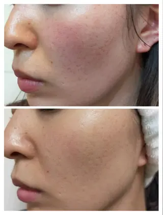 Sha.Lu.Lu.所属・本気の肌質改善/ ハーブピーリングのエステ・リラクイメージ